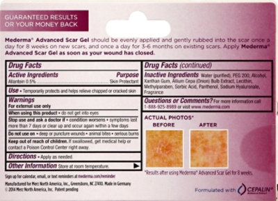 Mederma Skin Care For Scars Scar Gel Advanced - 0.7 Oz - Image 3