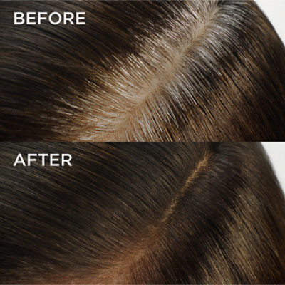 L'Oreal Paris Magic Root Rescue 10 Minute Root Hair Coloring Kit 7 Dark Blonde Kit - Each - Image 4