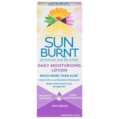 Sun Burnt After Sun Relief Lotion - 6 OZ - Image 1