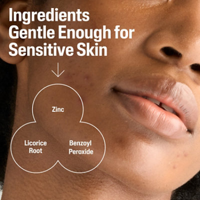 Cetaphil Gentle Clear Cleanser - 4.2 Fl. Oz. - Image 3