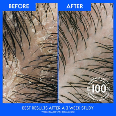 Head & Shoulders Itchy Scalp Care Anti-dandruff Shampoo - 12.5 Fl. Oz. - Image 6