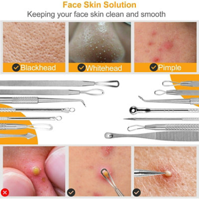 Eggracks by Global Phoenix Professional Blackhead Remover Kit - 7 Pcs - Achieve Clear, Smooth Skin - Image 2