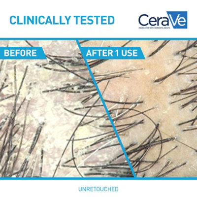 Cerave Anti Dandruff Hydrating Shampoo - 12 FZ - Image 5
