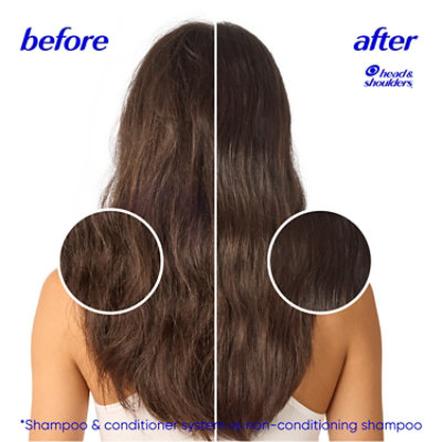 Head & Shoulders Base Shampoo Coconut Anti-dandruff - 370 ML - Image 5