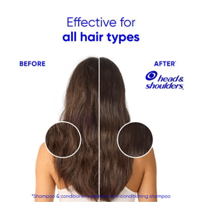 Head & Shoulders Base Shampoo Mixed Anti-dandruff - EA - Image 6