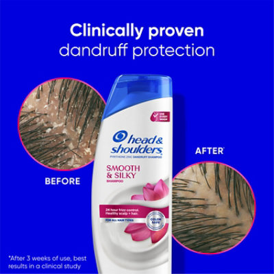 Head & Shoulders Base Hair Conditioner Smooth & Silky Rinse Off - 10.6 FZ - Image 5