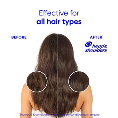 Head & Shoulders Base Hair Conditioner Smooth & Silky Rinse Off - 10.6 FZ - Image 6
